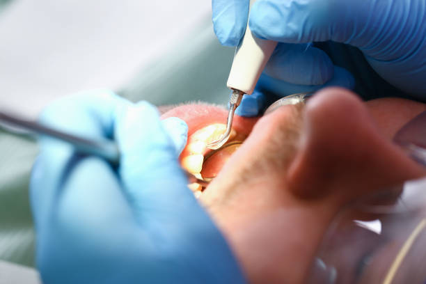 Best Emergency Treatment for Dental Infections or Abscesses in Fort Branch, IN